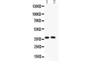 Anti-PD1 Picoband antibody , All lanes: Anti PD1  at 0. (PD-1 Antikörper  (AA 101-288))