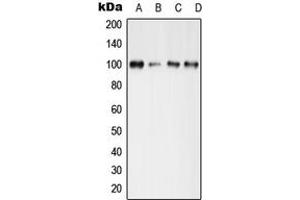 Western blot analysis of GLUR4 (pS862) expression in MCF7 Forskonlin-treated (A), mouse brain (B), mouse spleen (C), rat spleen (D) whole cell lysates.