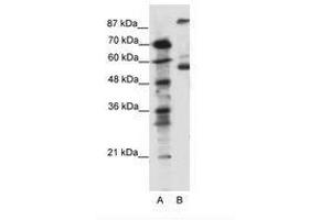 Image no. 1 for anti-5-Hydroxytryptamine (serotonin) Receptor 7 (Adenylate Cyclase-Coupled) (HTR7) (AA 47-96) antibody (ABIN6736094) (HTR7 Antikörper  (AA 47-96))