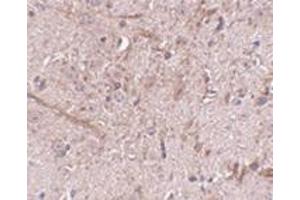 Immunohistochemistry of TOM70 in mouse brain tissue with this product at 2. (TOM70 Antikörper  (N-Term))