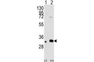 Western Blotting (WB) image for anti-Melanoma Antigen Family B, 2 (MAGEB2) antibody (ABIN3002533) (MAGEB2 Antikörper)