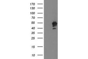 Western Blotting (WB) image for anti-Protein tyrosine Phosphatase, Non-Receptor Type 7 (PTPN7) antibody (ABIN1500502) (PTPN7 Antikörper)