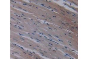 Immunohistochemistry (IHC) image for anti-Fatty Acid Binding Protein 3, Muscle and Heart (FABP3) (AA 1-133) antibody (ABIN1078017)