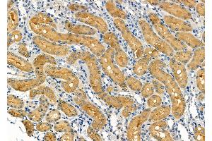 ABIN6264548 and ABIN6272405 at 1/100 staining Rat kidney tissue by IHC-P.
