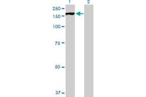 Western Blot analysis of PHKA2 expression in transfected 293T cell line by PHKA2 MaxPab polyclonal antibody. (PHKA2 Antikörper  (AA 1-1235))