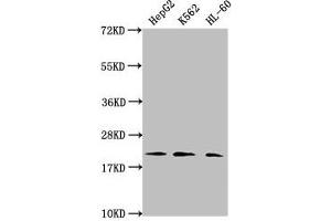 Western Blot Positive WB detected in: HepG2 whole cell lysate, K562 whole cell lysate, HL60 whole cell lysate All lanes: HIST1H1C antibody at 1:2000 Secondary Goat polyclonal to rabbit IgG at 1/40000 dilution Predicted band size: 22 kDa Observed band size: 22 kDa (HIST1H1C Antikörper  (2meLys45))