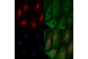 ABIN6261079 and ABIN6276536 staining  cells by IF/ICC. (CTCF Antikörper  (C-Term))