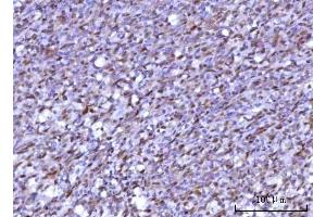 IHC analysis of RNF34 using anti-RNF34 antibody (ABIN7602457). (RNF34 Antikörper  (AA 46-372))
