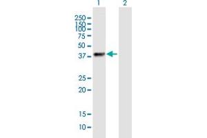 Western Blot analysis of ZNF385B expression in transfected 293T cell line by ZNF385B MaxPab polyclonal antibody. (ZNF385B Antikörper  (AA 1-369))