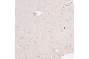 Immunohistochemistry of paraffin-embedded rat brain using ABCF2 antibody.