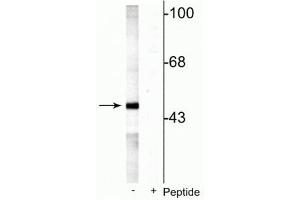 Western blot of rat testes lysate showing specific labeling of the ~49 kDa MEK5 protein phosphorylated at Ser311 Thr315 in the first lane (-). (MAP2K5 Antikörper  (pSer311, pThr315))