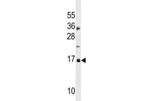 CDKN2A antibody western blot analysis in MDA-MB453 lysate. (CDKN2A Antikörper  (AA 1-30))