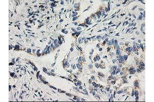 Image no. 5 for anti-Cyclin-Dependent Kinase 2 (CDK2) antibody (ABIN1497394) (CDK2 Antikörper)