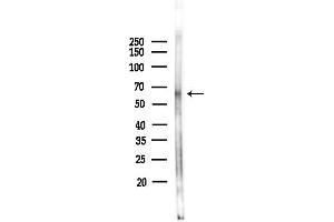 anti-Resistance To Inhibitors of Cholinesterase 8 Homolog B (RIC8B) (C-Term) antibody