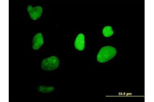 Immunofluorescence of purified MaxPab antibody to XRCC1 on HeLa cell. (XRCC1 Antikörper  (AA 1-633))