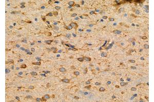 ABIN6264935 and ABIN6276742 at 1/100 staining Rat brain tissue by IHC-P. (SCARB1 Antikörper  (Internal Region))