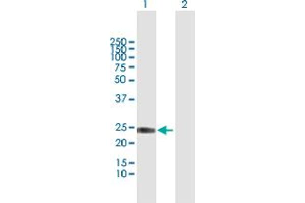 IFNA8 Antikörper  (AA 1-189)