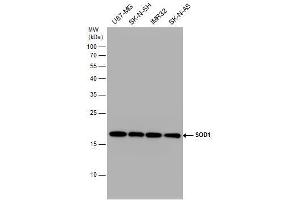 WB Image SOD1 antibody detects SOD1 protein by western blot analysis. (SOD1 Antikörper)