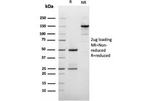 SDS-PAGE Analysis Purified Filaggrin Mouse Recombinant Monoclonal Antibody (rFLG/1561). (Rekombinanter Filaggrin Antikörper  (AA 198-288))