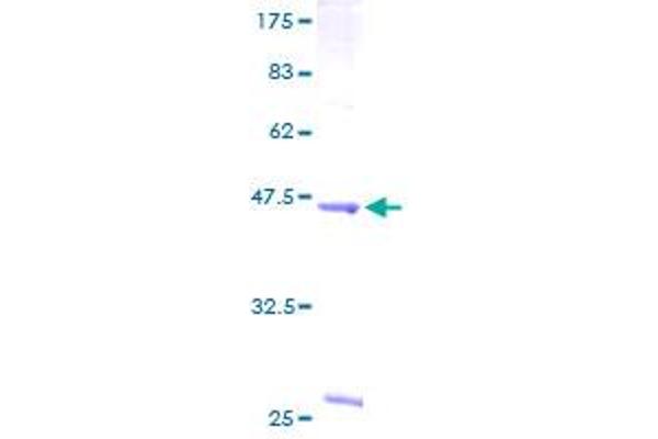 Phospholipase C beta 2 Protein (AA 1-199) (GST tag)