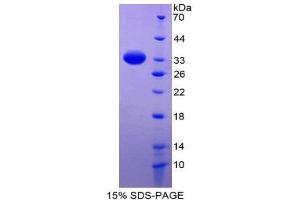 SDS-PAGE (SDS) image for Renin Binding Protein (RENBP) (AA 1-254) protein (His tag) (ABIN1981105)