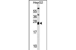 ZNRF1 Antibody (Center) (ABIN1538511 and ABIN2848452) western blot analysis in HepG2 cell line lysates (35 μg/lane). (ZNRF1 Antikörper  (AA 59-86))