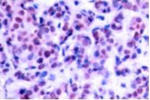 Image no. 1 for anti-Jun D Proto-Oncogene (JUND) (pSer255) antibody (ABIN318059)