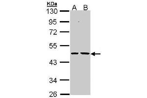 WB Image Sample (30 ug of whole cell lysate) A: H1299 B: Hela 10% SDS PAGE antibody diluted at 1:1000 (EPHX1 Antikörper)