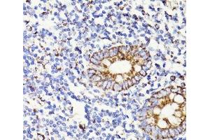Immunohistochemistry (Paraffin-embedded Sections) (IHC (p)) image for anti-Programmed Cell Death 10 (PDCD10) antibody (ABIN7009630)
