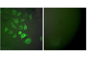 Immunofluorescence analysis of A549 cells, using S100 A1 antibody (ABIN5976502). (S100A1 Antikörper  (N-Term))