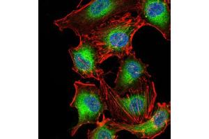 Immunocytochemistry (ICC) image for anti-3-phosphoinositide Dependent Protein Kinase-1 (PDPK1) (AA 457-556) antibody (ABIN5855659) (PDPK1 Antikörper  (AA 457-556))