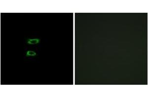 Immunofluorescence analysis of A549 cells, using BMP8A Antibody. (BMP8A Antikörper  (AA 253-302))