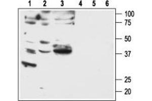 Western blot analysis of human breast adenocarcinoma MDA-MB-231 (lanes 1 and 4) and MDA-MB-468 (lanes 2 and 5), and human lung small cell carcinoma NCI-H526 (lanes 3 and 6) cell lines: - 1-3. (F2RL1 Antikörper  (C-Term, Intracellular))