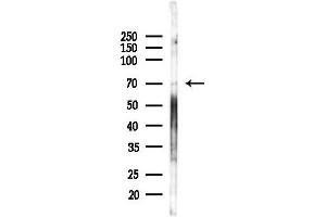 anti-Suppressor of Variegation 4-20 Homolog 2 (SUV420H2) (Internal Region) antibody