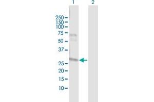 Western Blot analysis of NAT2 expression in transfected 293T cell line by NAT2 MaxPab polyclonal antibody. (NAT2 Antikörper  (AA 1-290))