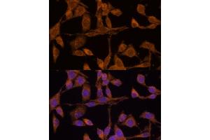 Immunofluorescence analysis of HeLa cells using USP15 Polyclonal Antibody (ABIN6130759, ABIN6149998, ABIN6149999 and ABIN6222530) at dilution of 1:100 (40x lens). (USP15 Antikörper  (AA 852-952))