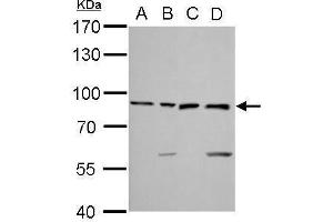 WB Image Ku80 antibody [N3C2], Internal detects XRCC5 protein by Western blot analysis. (X-Ray Repair Cross Complementing 5 Antikörper)