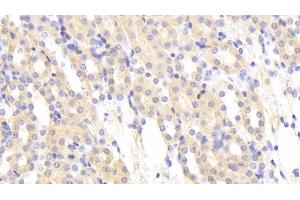 Detection of MASP1 in Mouse Kidney Tissue using Polyclonal Antibody to Mannose Associated Serine Protease 1 (MASP1) (MASP1 Antikörper  (AA 25-453))