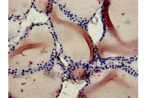 Immunohistochemistry of paraffin-embedded human thyroid tissue using ABIN7167100 at dilution of 1:100 (RBCK1 Antikörper  (AA 162-261))