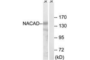 Western blot analysis of extracts from Jurkat cells, using NACAD Antibody. (NACAD Antikörper  (AA 376-425))