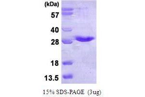 SDS-PAGE (SDS) image for NFKB Inhibitor Interacting Ras-Like 1 (NKIRAS1) (AA 1-192) protein (His tag) (ABIN6386901)