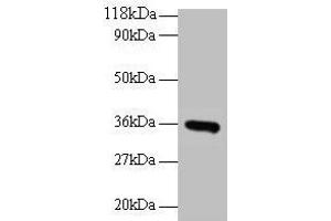 Western blot All lanes: CYC1 antibody at 2 μg/mL + EC109 whole cell lysate Secondary Goat polyclonal to rabbit IgG at 1/15000 dilution Predicted band size: 36 kDa Observed band size: 36 kDa (Cytochrome C1 Antikörper  (AA 85-325))