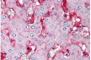 Human Liver (formalin-fixed, paraffin-embedded) stained with B2M antibody ABIN239806 at 5 ug/ml followed by biotinylated anti-mouse IgG secondary antibody ABIN481714, alkaline phosphatase-streptavidin and chromogen. (beta-2 Microglobulin Antikörper)