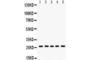 Western Blotting (WB) image for anti-Hydroxysteroid (17-Beta) Dehydrogenase 10 (HSD17B10) (AA 48-261) antibody (ABIN3042460) (HSD17B10 Antikörper  (AA 48-261))