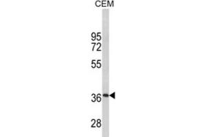 Western Blotting (WB) image for anti-Myelin Protein Zero (MPZ) antibody (ABIN3003838) (MPZ Antikörper)