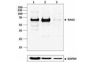 Western Blotting (WB) image for anti-Recombination Activating Gene 2 (RAG2) antibody (ABIN2666293) (RAG2 Antikörper)