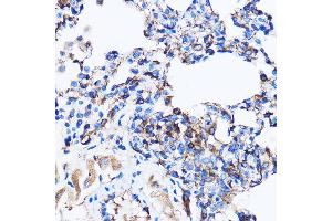 Immunohistochemistry of paraffin-embedded Rat lung using p38 MAPK Rabbit pAb (ABIN7268615) at dilution of 1:100 (40x lens).