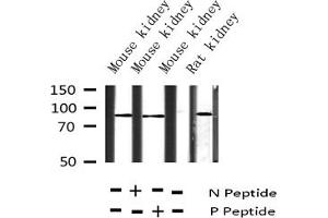 Western blot analysis of Phospho-Tau (Ser404) expression in various lysates (MAPT Antikörper  (pSer404))