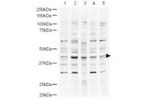 Image no. 1 for anti-Ubiquitin Specific Peptidase 18 (USP18) (AA 40-49) antibody (ABIN401252) (USP18 Antikörper  (AA 40-49))