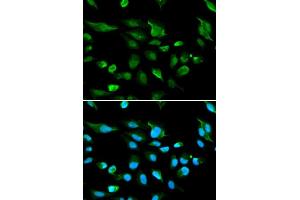 Immunofluorescence analysis of A549 cell using AIRE antibody. (AIRE Antikörper  (AA 30-130))